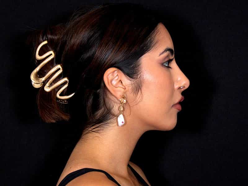 Rhinoplasty Before & After Photo