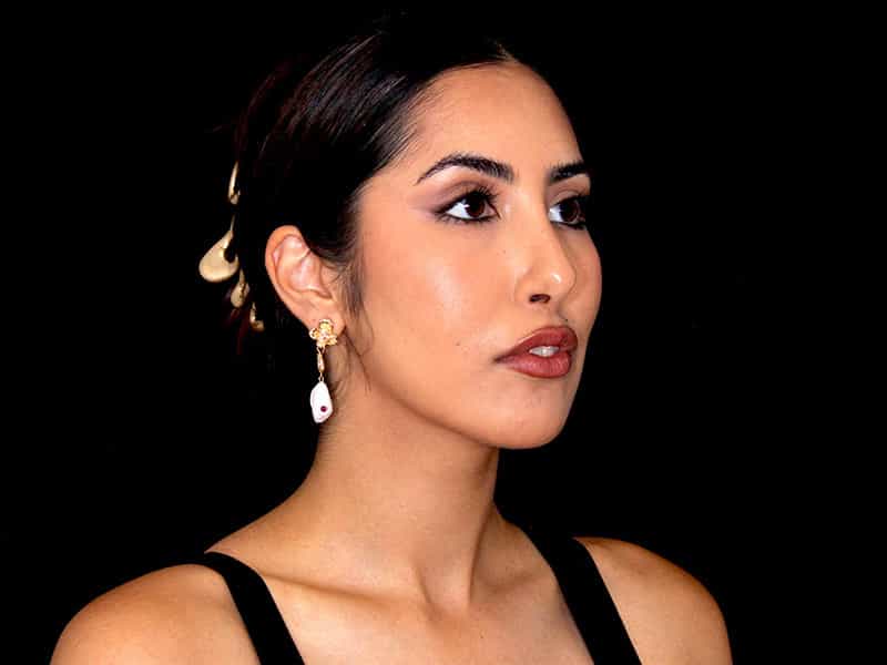 Rhinoplasty Before & After Image